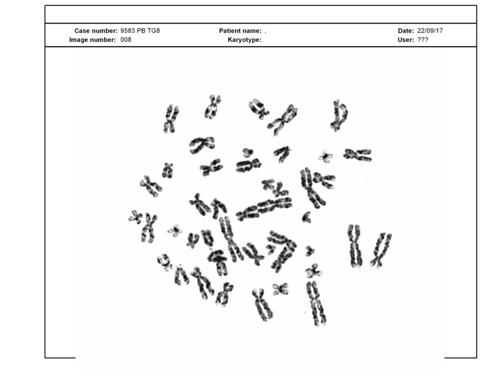 The X-shape of chromosomes. 