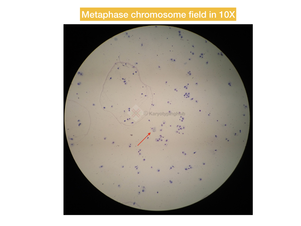 The metaphase field for karyotyping under 10X microscope lense.