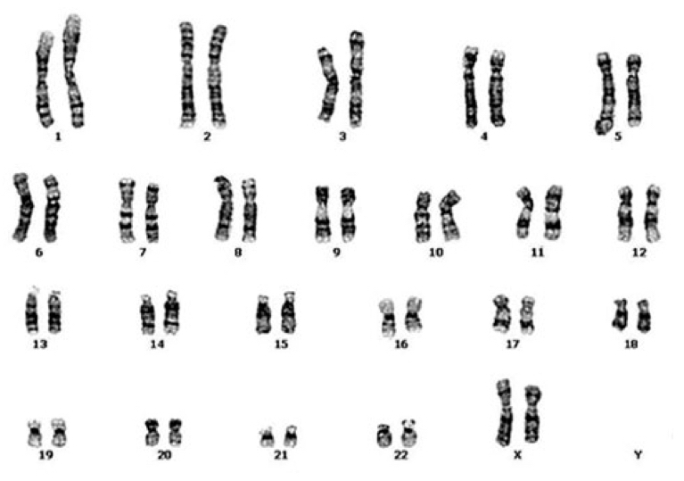 The pair of human karyotype 