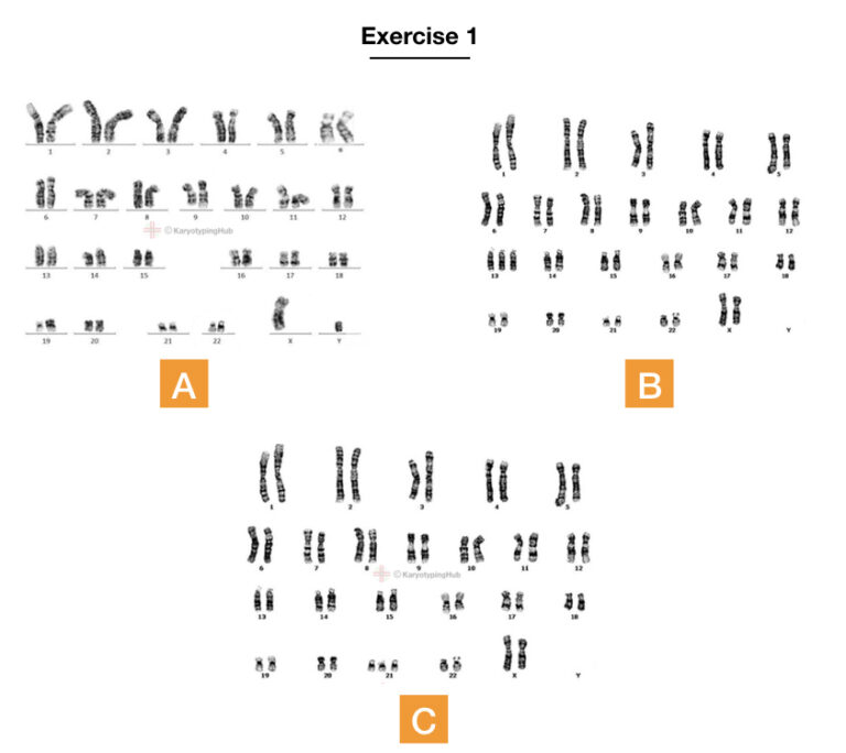 10 Best Karyotyping Activities And Assignments – KaryotypingHub