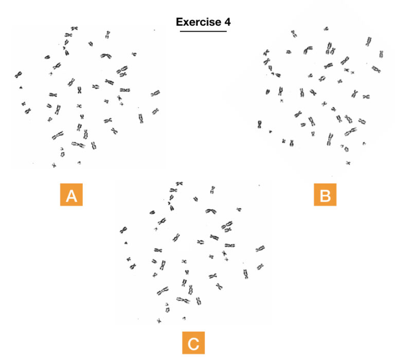 10 Best Karyotyping Activities And Assignments – KaryotypingHub