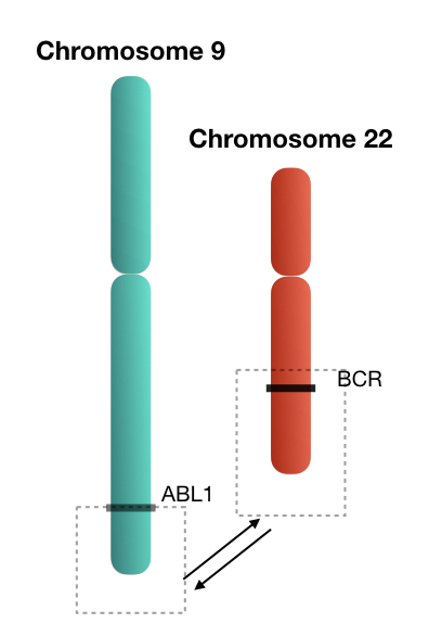 Translocation between chromosome 9 and 22. 
