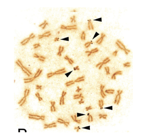 The Image of NOR banding using silver nitrate. 