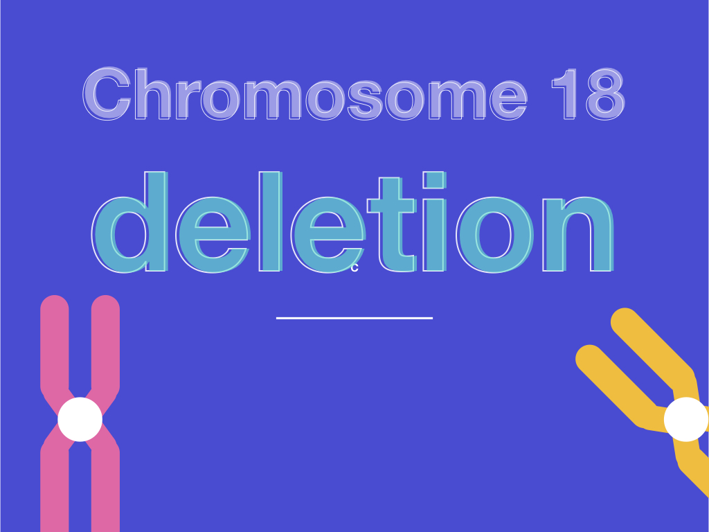 Chromosome 18 Deletion- Deletion 18p, 18q Distal and 18q Proximal