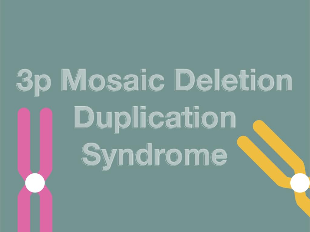 The rarest case of 3p Mosaic Deletion Duplication Syndrome – KaryotypingHub